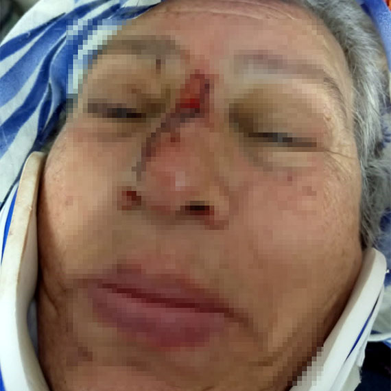 Bitlis'in Ahlat ilçesinde yaşayan E.K. eski eşi ile annesini dövdü, darbedildiği iddiasıyla polis merkezine giderek şikayetçi oldu.