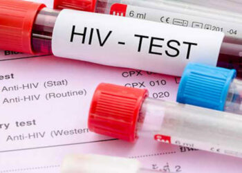 HIV vakalarında artış; 15-24 yaş grubunda daha fazla