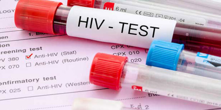 HIV vakalarında artış; 15-24 yaş grubunda daha fazla