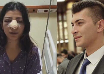 Genç kızın burnunu kıran AK Parti Keskin Gençlik Kolları Başkanı serbest bırakıldı