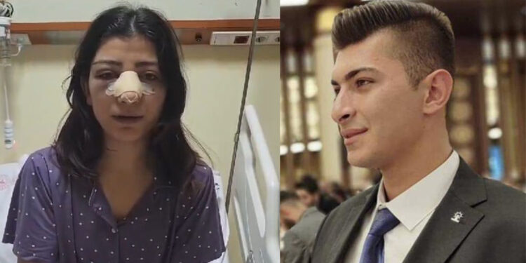 Genç kızın burnunu kıran AK Parti Keskin Gençlik Kolları Başkanı serbest bırakıldı