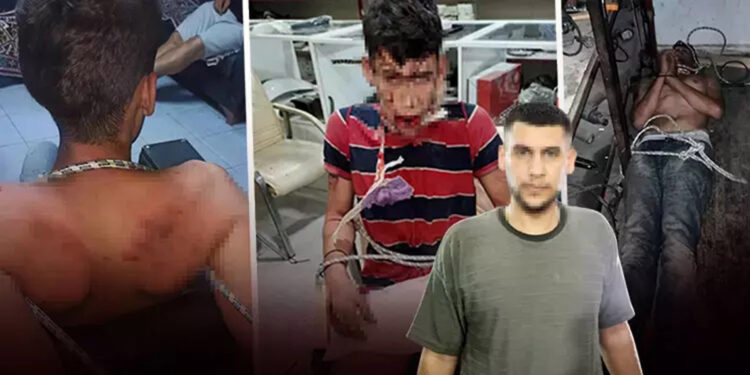 Maaşını isteyen işçiye işkence! Dişlerini kerpetenle çekip böcek yedirdiler