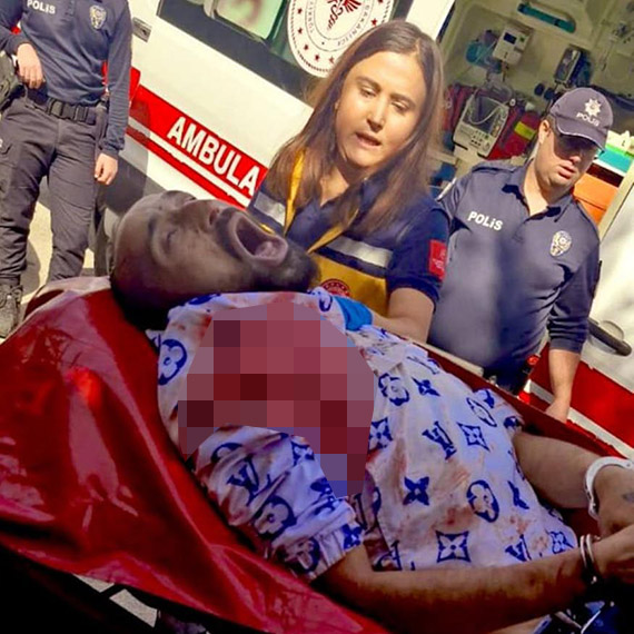 Polisi yaralayan saldırgan, son 9 ayda 10 suça karışıp serbest kalmış