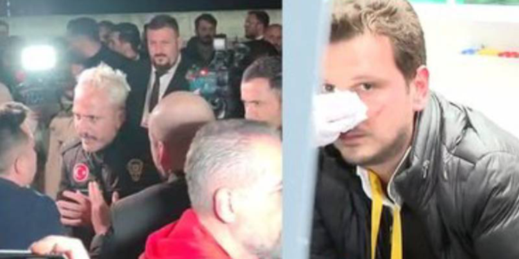 Spor muhabirine yumruk atan şüpheli gözaltına alındı