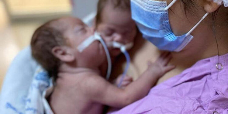 Türkiye’de her 10 bebekten 1'i erken doğuyor