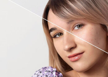 35'inden önce başlanan anti aging uygulamaları erken çöküşe yol açıyor