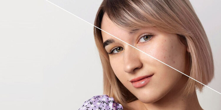 35'inden önce başlanan anti aging uygulamaları erken çöküşe yol açıyor