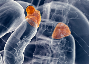 Adrenal kitleler, büyüyerek ciddi sağlık sorunlarına yol açabilir