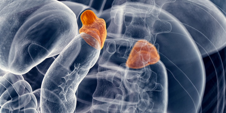 Adrenal kitleler, büyüyerek ciddi sağlık sorunlarına yol açabilir