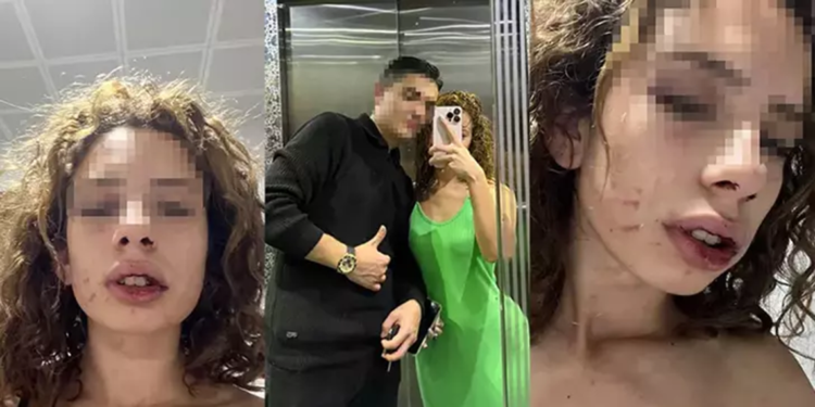 Kendisinden ayrılmak isteyen sevgilisini saatlerce dövdü