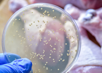 Prof. Dr. Yaşar Bayındır’dan salmonella enfeksiyonu uyarısı