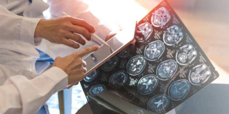 Yetersiz uyku demans riskini artırıyor