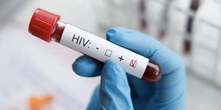 Yılda yaklaşık iki milyon yeni HIV vakası görülmeye devam ediyor