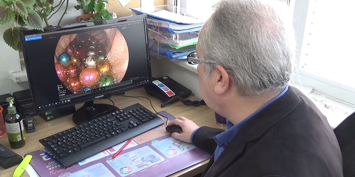 5 yaşındaki çocuğun bağırsağından 38 adet mıknatıslı boncuk çıkarıldı