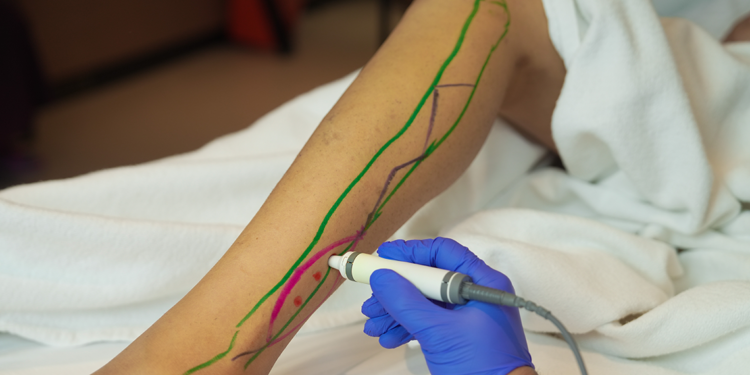 Deri ve doku transferleri hastaların yaşam kalitesini artırıyor