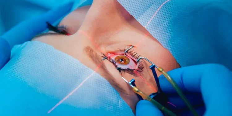 SMILE Pro lazer tedavisi hipermetrop ve astigmatta da uygulanabilecek