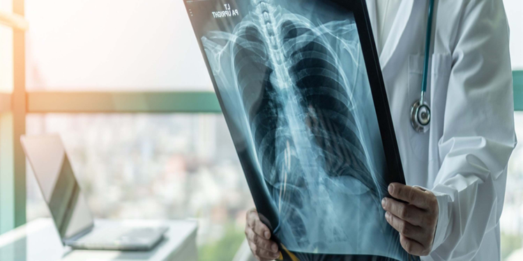 Solunum yolu enfeksiyonları nedeniyle yoğun bakıma yatışlar arttı