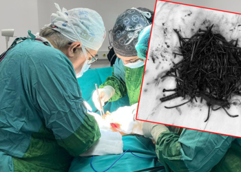 Zihinsel engelli kadın hastanın midesinden 1 kilo metal cisim çıktı