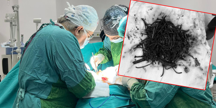 Zihinsel engelli kadın hastanın midesinden 1 kilo metal cisim çıktı