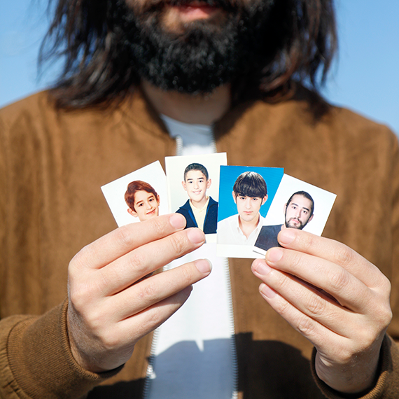 Yüzündeki tümör yalnızlığa itti, kendini müziğe adayıp müzisyen oldu