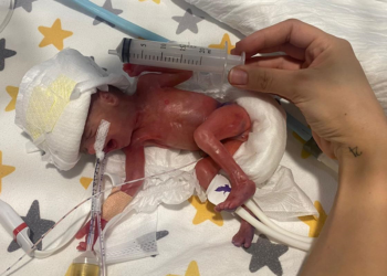 380 gram doğan Hira Su bebek hayata tutundu