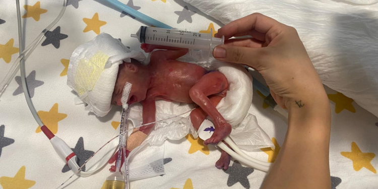 380 gram doğan Hira Su bebek hayata tutundu