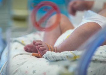 Doğuştan kalp hastası prematüre bebek hayata tutundu