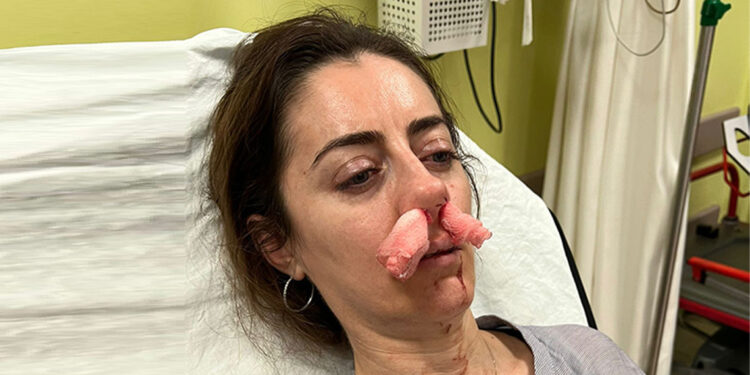 Kendisini eşinin sevgilisi zanneden kadın tarafından darbedildi