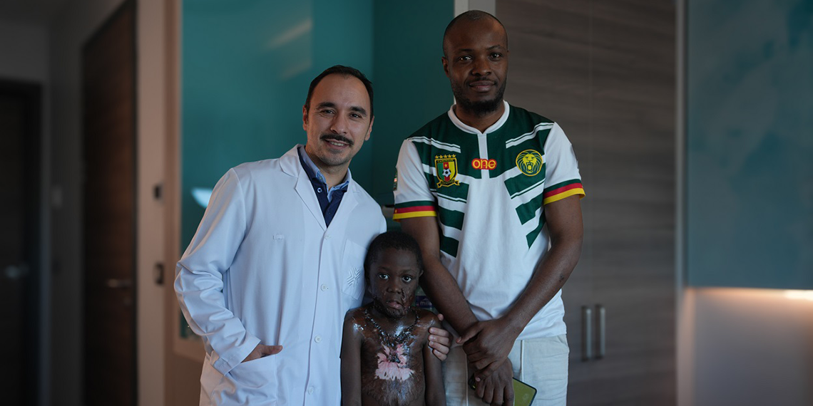 Oyun oynarken yanan Kamerunlu çocuk, sağlığına kavuştu