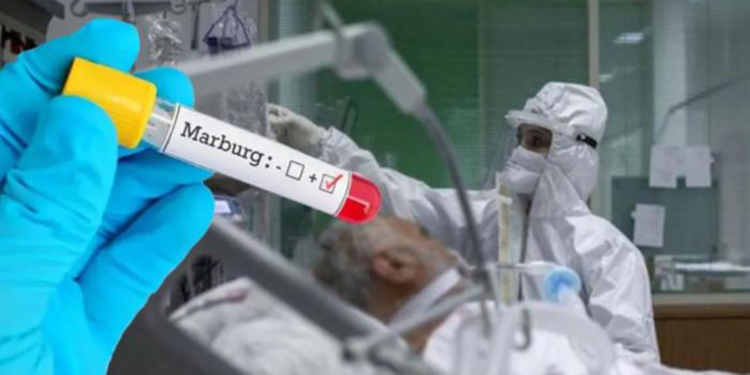 Tanzanya'da Marburg virüsü nedeniyle 8 kişi hayatını kaybetti