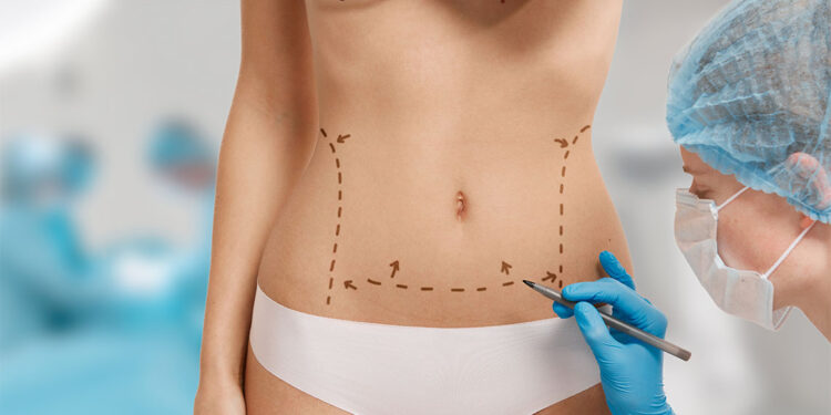 Karın germe ameliyatında sigara kullanımı en büyük risk