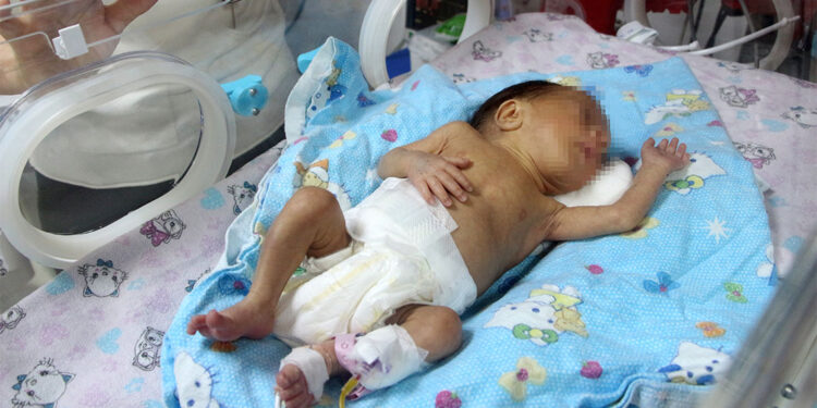 Yenidoğan adı gölgelenmemeli