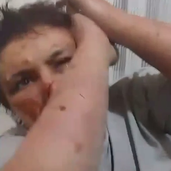 Ankara'da bir kadını zorla alıkoyup, darbeden 2 kişi tutuklandı