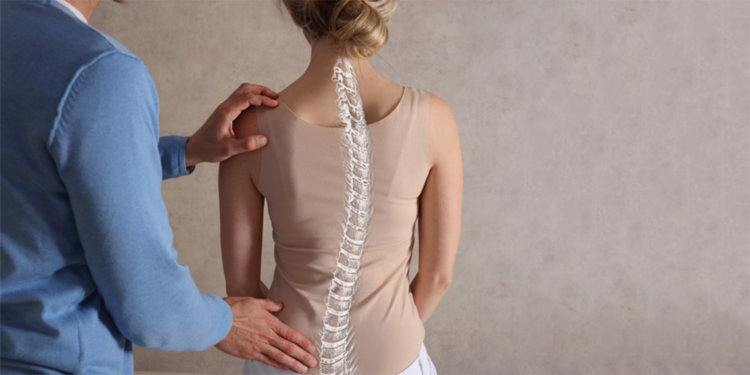 Erken evrede yakalanan skolyoz, egzersizle kontrol altına alınabilir