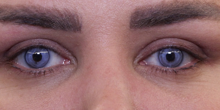 Göz rengi değiştirme ameliyatlarına talep artıyor