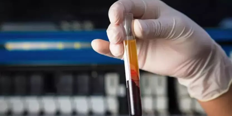 Kandaki yağ oranının kontrol edilmesi önemli