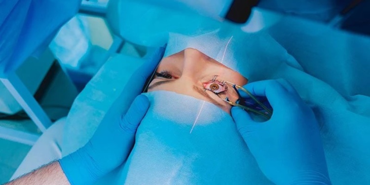 Lazer tedavisi kişiye ve göz yapısına özel yapılmalı