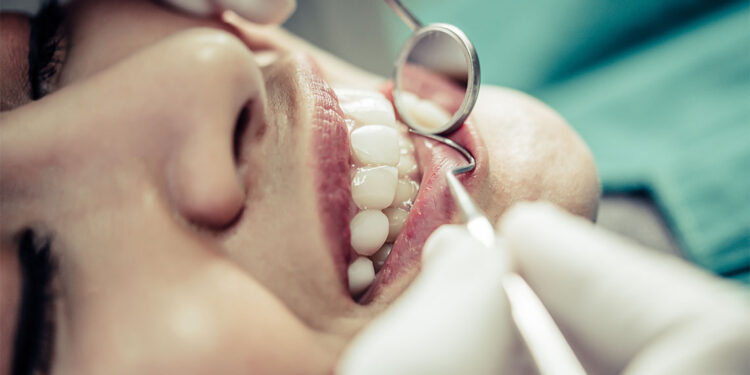 Çocukların diş sağlığını korumada florürün önemi