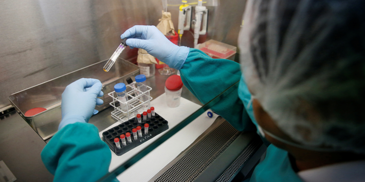 ABD’de tüberküloz vakalarında artış sürüyor