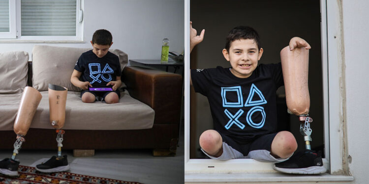 Bacakları kesilen Aras'ın protez borcuna icra işlemi