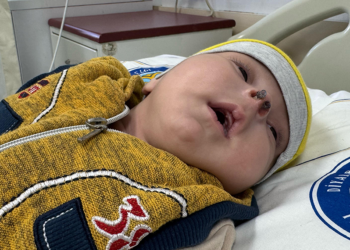 Burun kanalları kapalı dünyaya gelen Emani bebek, sağlığına kavuştu