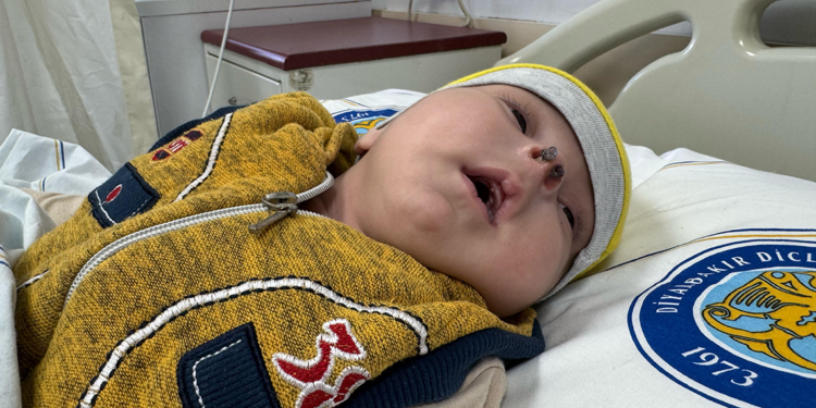 Burun kanalları kapalı dünyaya gelen Emani bebek, sağlığına kavuştu