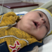 Burun kanalları kapalı dünyaya gelen Emani bebek, sağlığına kavuştu