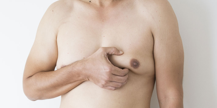 Erkeklerde jinekomasti sorunu büyüyor