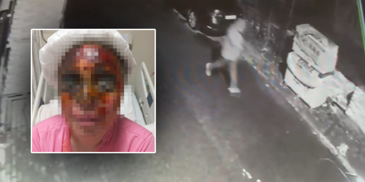 Görüşme teklifini reddeden kadına kezzapla saldırdı