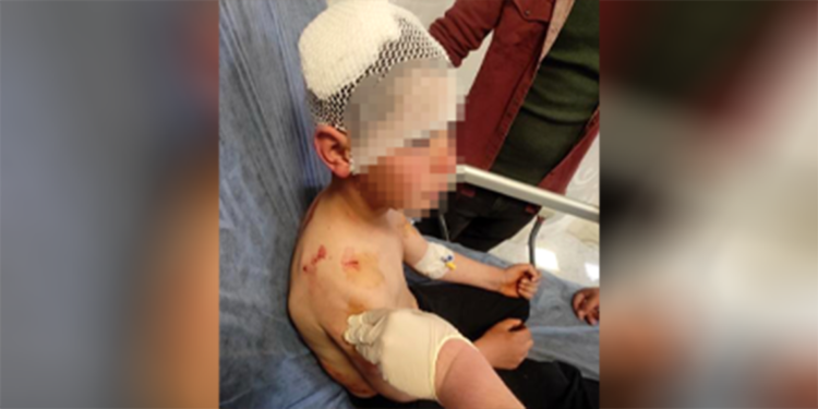 Köpeğin saldırdığı 9 yaşındaki çocuk yaralandı