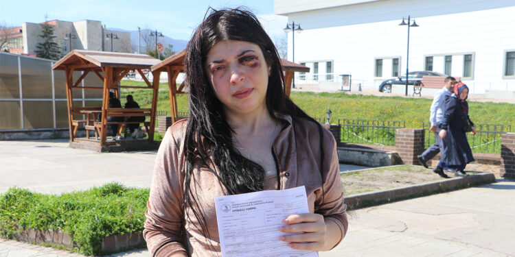 Sokak ortasında darbedilen Damla 3 ay sıvı ile beslenecek