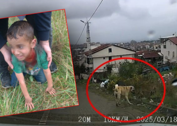Sokak köpeğinin saldırdığı 6 yaşındaki çocuk ağır yaralandı