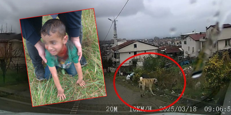 Sokak köpeğinin saldırdığı 6 yaşındaki çocuk ağır yaralandı