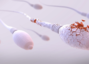 Sperm DNA Hasarı, başarısız gebeliklerin gizli sebebi olabilir